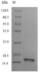 Greater than 85% as determined by SDS-PAGE.Recombinant Human Lymphocyte Antigen 6 Complex Locus Protein G6D (LY6G6D) Protein (His-B2M-JD)