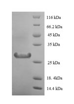 Greater than 90% as determined by SDS-PAGE.Recombinant Human Lysozyme C (LYZ) Protein (His-SUMO)