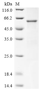 Greater than 90% as determined by SDS-PAGE.Recombinant Human Myelin-Associated Glycoprotein (MAG) Protein (His)