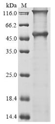 Greater than 90% as determined by SDS-PAGE.Recombinant Human Melanoma-Associated Antigen 12 (MAGEA12) Protein (His&Myc)