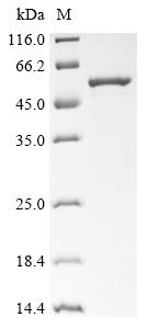 Greater than 85% as determined by SDS-PAGE.Recombinant Human Melanoma-Associated Antigen B1 (MAGEB1) Protein (His&Myc)
