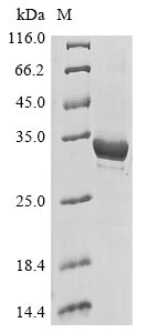 Greater than 85% as determined by SDS-PAGE.Recombinant Human Microtubule-Associated Protein 1A (MAP1A) Protein (His)