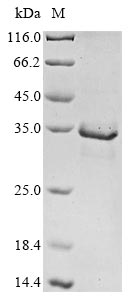Greater than 85% as determined by SDS-PAGE.Recombinant Human Mitogen-Activated Protein Kinase Kinase Kinase 14 (MAP3K14) Protein (His&Myc)