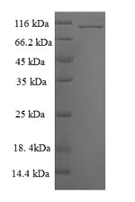 Greater than 90% as determined by SDS-PAGE.Recombinant Human Mitogen-Activated Protein Kinase 6 (MAPK6) Protein (His-SUMO)