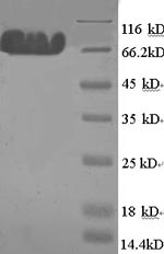 Greater than 90% as determined by SDS-PAGE.Recombinant Rat Microtubule-Associated Protein Tau (MAPT) Protein (His)