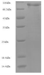 Greater than 90% as determined by SDS-PAGE.Recombinant Human Mannan-Binding Lectin Serine Protease 1 (MASP1) Protein (His-SUMO)