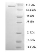 Greater than 90% as determined by SDS-PAGE.Recombinant Human Dna Replication Licensing Factor Mcm2 (MCM2) Protein (His)