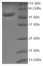 Greater than 90% as determined by SDS-PAGE.