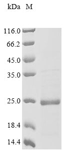 Greater than 85% as determined by SDS-PAGE.Recombinant Chicken Midkine (RIHB) Protein (His&Myc)
