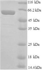 Greater than 90% as determined by SDS-PAGE.Recombinant Mouse E3 Ubiquitin-Protein Ligase Mdm2 (MDM2) Protein (His)