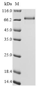 Greater than 90% as determined by SDS-PAGE.Recombinant Human Protein Mdm4 (MDM4) Protein (His)