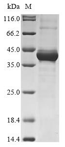 Greater than 85% as determined by SDS-PAGE.Recombinant Human Maternal Embryonic Leucine Zipper Kinase (MELK) Protein (His&Myc)