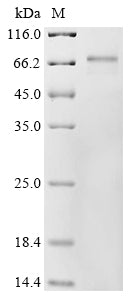 Greater than 85% as determined by SDS-PAGE.Recombinant Human Rna-Binding Protein Mex3A (MEX3A) Protein (His&Myc)