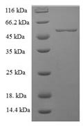 Greater than 90% as determined by SDS-PAGE.Recombinant Human Lactadherin (MFGE8) Protein (His-SUMO)
