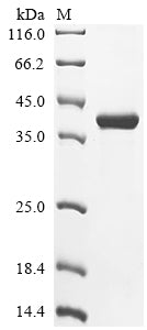 Greater than 85% as determined by SDS-PAGE.