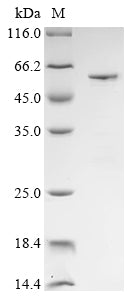 Greater than 85% as determined by SDS-PAGE.Recombinant Rabbit Alpha-1,3-Mannosyl-Glycoprotein 2-Beta-N-Acetylglucosaminyltransferase (MGAT1) Protein (His&Myc)
