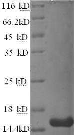 Greater than 90% as determined by SDS-PAGE.Recombinant Human Matrix Gla Protein (MGP) Protein (His)