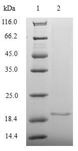 Greater than 90% as determined by SDS-PAGE.Recombinant Human Proliferation Marker Protein Ki-67 (MKI67) Protein (His)