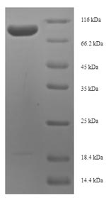 Greater than 90% as determined by SDS-PAGE.Recombinant Human Proliferation Marker Protein Ki-67 (MKI67) Protein (His-SUMO)