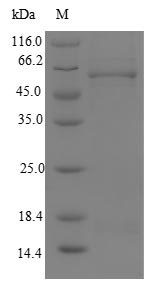 Greater than 90% as determined by SDS-PAGE.Recombinant Human Malonyl-Coa Decarboxylase, Mitochondrial (MLYCD) Protein (His&Myc)