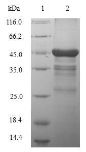 Greater than 90% as determined by SDS-PAGE.Recombinant Human Macrophage Metalloelastase (MMP12) Protein (His)