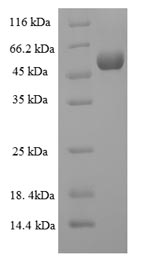 Greater than 90% as determined by SDS-PAGE.Recombinant Human Collagenase 3 (MMP13) Protein (His-SUMO)