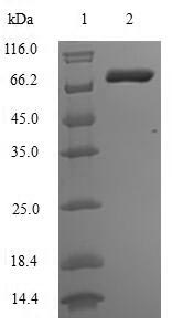 Greater than 90% as determined by SDS-PAGE.Recombinant Human Matrix Metalloproteinase-14 (MMP14) Protein (His-SUMO)