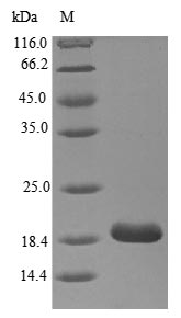 Greater than 85% as determined by SDS-PAGE.Recombinant Human Myelin Protein P0 (MPZ) Protein (His)