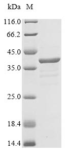 Greater than 90% as determined by SDS-PAGE.Recombinant Human Myelin Protein P0 (MPZ) Protein (GST)