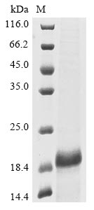 Greater than 85% as determined by SDS-PAGE.Recombinant Mouse Metallothionein-3 (MT3) Protein (His&Myc)
