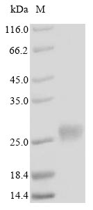Greater than 85% as determined by SDS-PAGE.Recombinant Human Metallothionein-4 (MT4) Protein (His-SUMO)