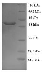 Greater than 90% as determined by SDS-PAGE.Recombinant Human Mucin-2 (MUC2) Protein (His-SUMO)