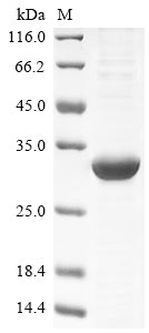 Greater than 85% as determined by SDS-PAGE.Recombinant Human Mucin-2 (MUC2) Protein (His)