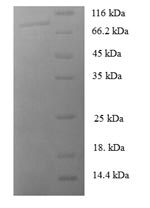 Greater than 90% as determined by SDS-PAGE.Recombinant Human Muscle, Skeletal Receptor Tyrosine-Protein Kinase (MUSK) Protein (GST)