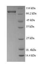 Greater than 90% as determined by SDS-PAGE.Recombinant Mouse Myc Proto-Oncogene Protein (MYC) Protein (GST)