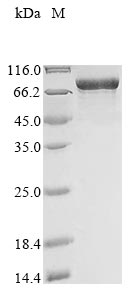 Greater than 85% as determined by SDS-PAGE.Recombinant Human Myosin-6 (MYH6) Protein (His)