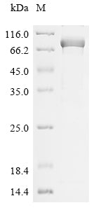 Greater than 85% as determined by SDS-PAGE.Recombinant Human Myosin-6 (MYH6) Protein (His)