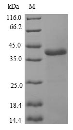 Greater than 90% as determined by SDS-PAGE.