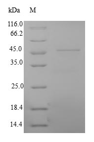 Greater than 90% as determined by SDS-PAGE.Recombinant Human Myosin Light Chain 3 (MYL3) Protein (GST)