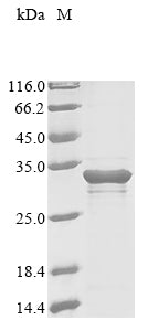 Greater than 85% as determined by SDS-PAGE.Recombinant Mouse Myocilin (MYOC) Protein (His)