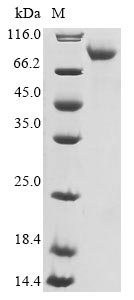 Greater than 85% as determined by SDS-PAGE.Recombinant Human Neuron Navigator 1 (NAV1) Protein (His)