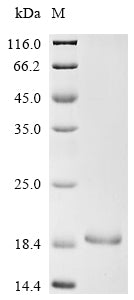 Greater than 85% as determined by SDS-PAGE.Recombinant Mouse Neuron Navigator 3 (NAV3) Protein (His)
