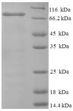 Greater than 90% as determined by SDS-PAGE.Recombinant Human Bifunctional Heparan Sulfate N-Deacetylase/N-Sulfotransferase 1 (NDST1) Protein (His-SUMO)