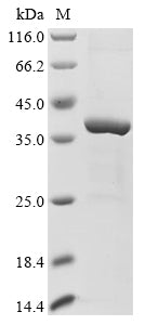 Greater than 85% as determined by SDS-PAGE.Recombinant Mouse Bifunctional Heparan Sulfate N-Deacetylase/N-Sulfotransferase 2 (NDST2) Protein (His&Myc)