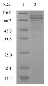Greater than 90% as determined by SDS-PAGE.Recombinant Human Neurofilament Light Polypeptide (NEFL) Protein (His-SUMO&Myc)