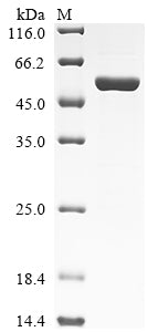 Greater than 85% as determined by SDS-PAGE.Recombinant Human Neurofilament Light Polypeptide (NEFL) Protein (His-SUMO)