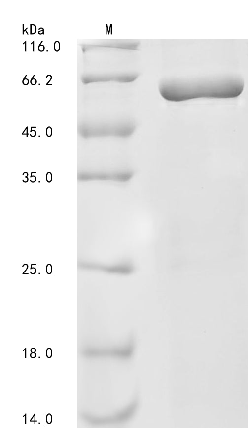 Greater than 85% as determined by SDS-PAGE.Recombinant Human Neurofilament Light Polypeptide (NEFL)