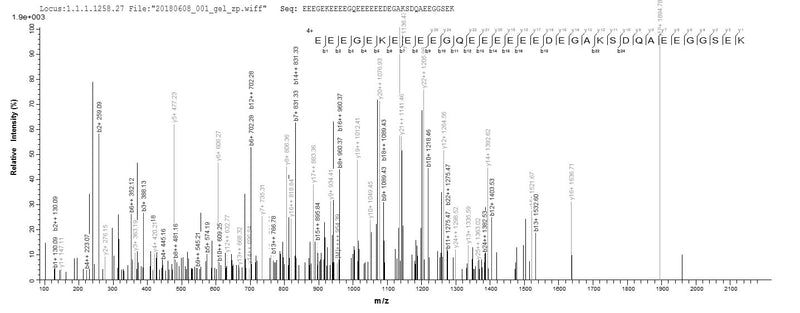 Based on the SEQUEST from database of E.coli host and target protein, the LC-MS/MS Analysis result of this product could indicate that this peptide derived from E.coli-expressed Homo sapiens (Human) NEFM.Recombinant Human Neurofilament Medium Polypeptide (NEFM) Protein (His&Myc)
