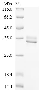 Greater than 85% as determined by SDS-PAGE.Recombinant Chicken Neurofibromin (NF1) Protein (His&Myc)