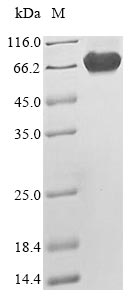 Greater than 85% as determined by SDS-PAGE.Recombinant Human Merlin (NF2) Protein (His)